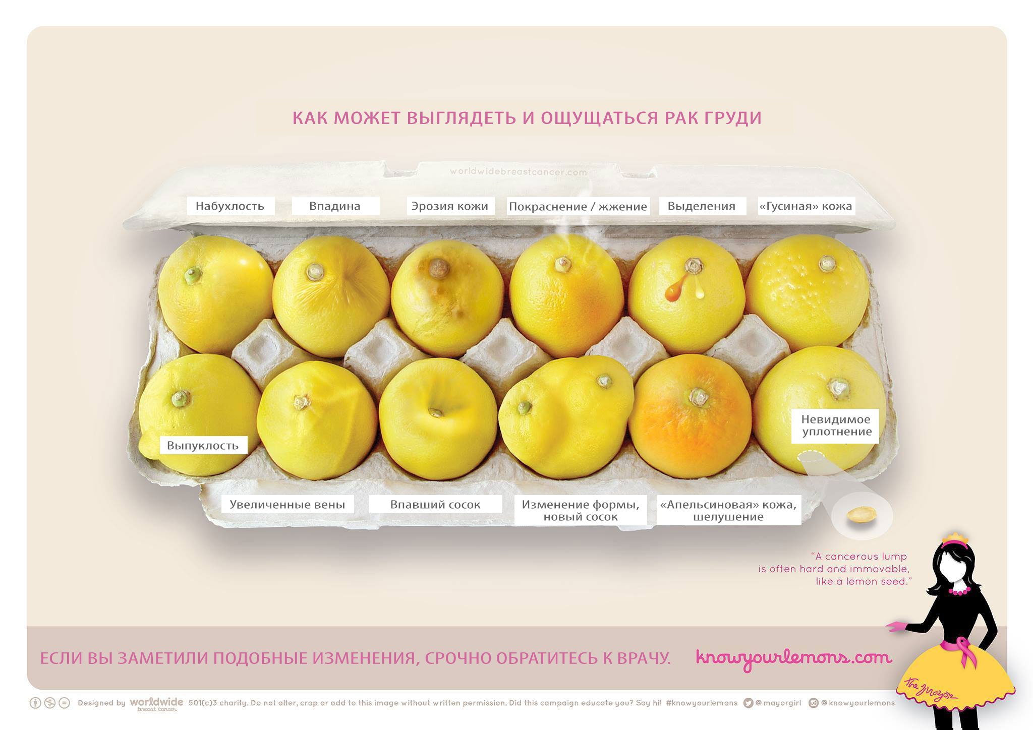 Фото лимонов, которое может стоить жизни: 12 признаков рака груди